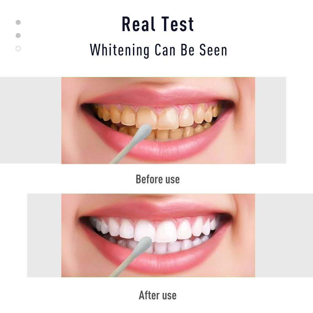 Pen Tooth Gel White  Kit Clean - Whitening Pen Bleach review and price