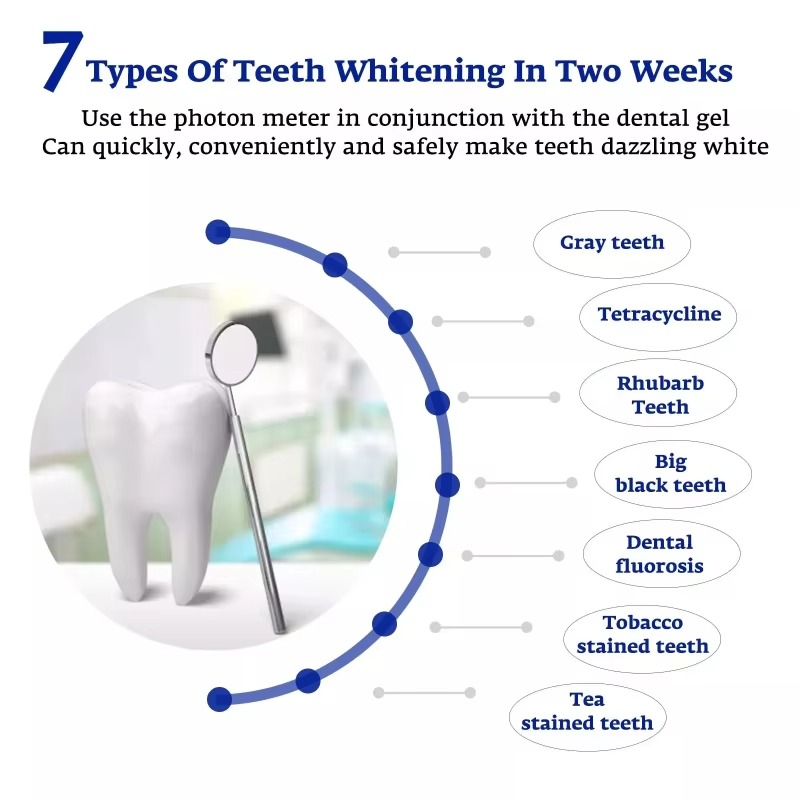 Intelligent LED Blue Light Por - Teeth Whitening For Trays review and price