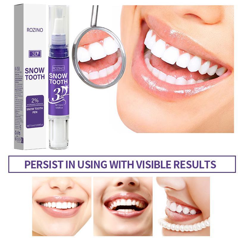 New Portable Teeth Whitening P - Whitening Pen Bleach review and price
