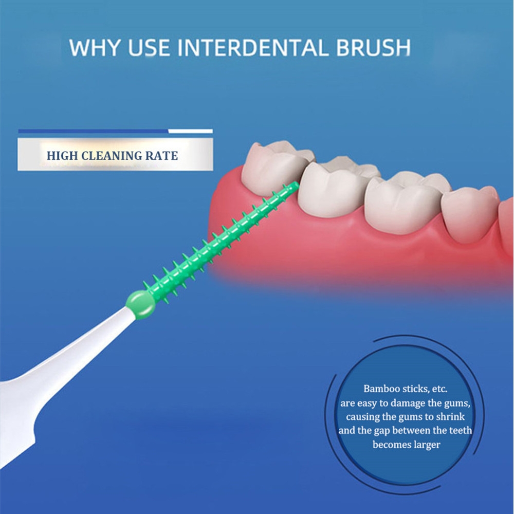 40~150PCS Silicone Interdental - Teeth Whitening For Braces review and price