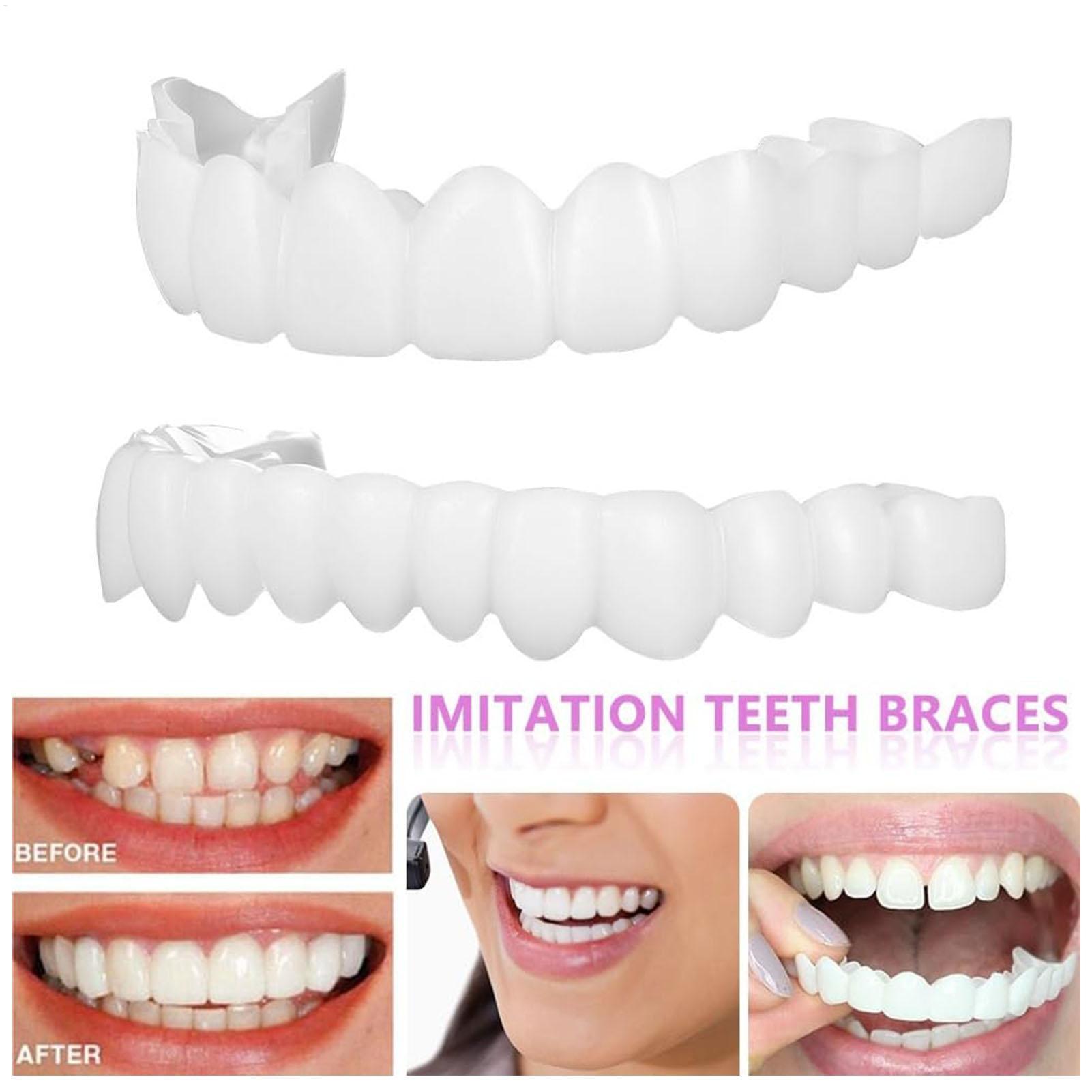 Dental Upper Lower Fake Teeth  - Teeth Whitening For Braces review and price
