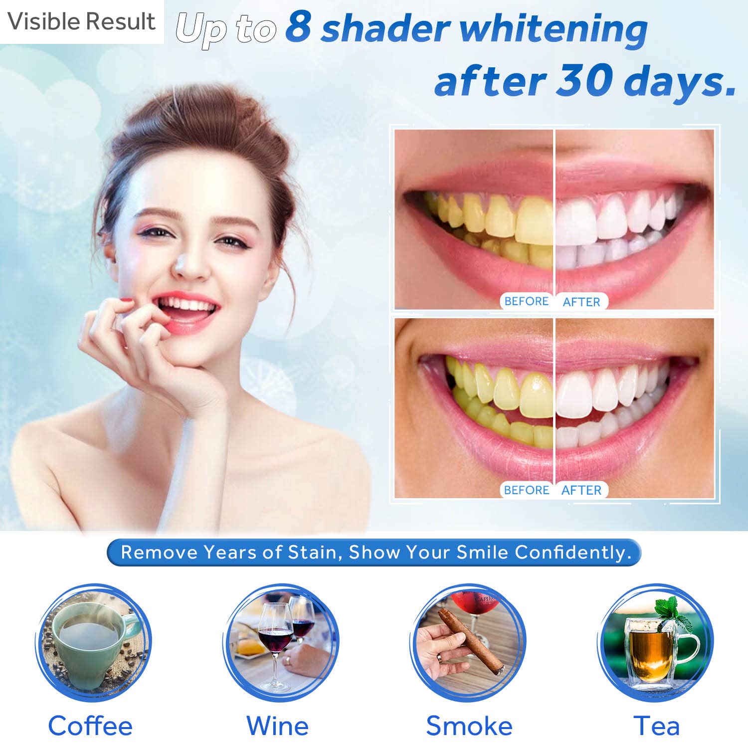Teeth Whitening Gel Refill Syr - Teeth Whitening Q&M review and price
