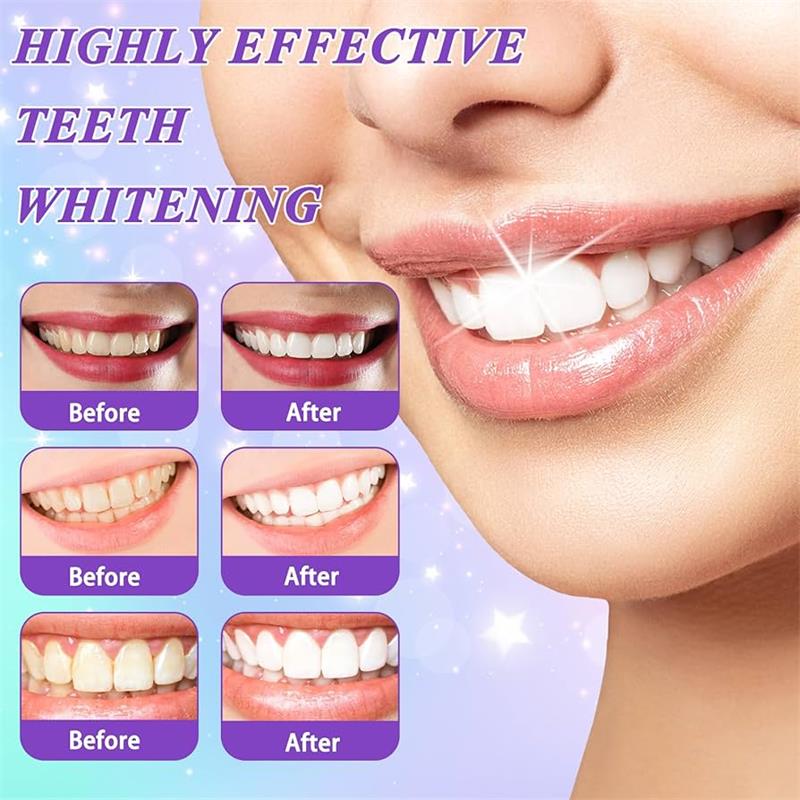 9D Purple Teeth Whitening Toot - Teeth Whitening Yellow Teeth review and price