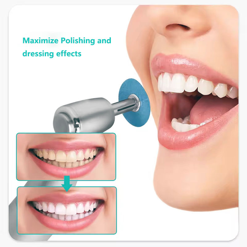 40pcs Dental Polishing Discs H - Teeth Whitening Express review and price