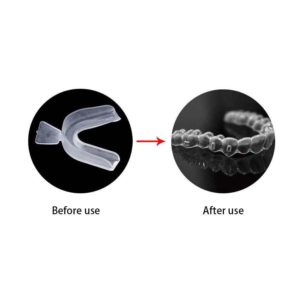 Teeth Covers Sleep Aid Tooth P - Teeth Whitening For Trays review and price