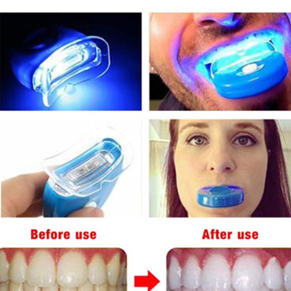 New Blue Led Teeth Whitening A - Teeth Whitening Laser review and price