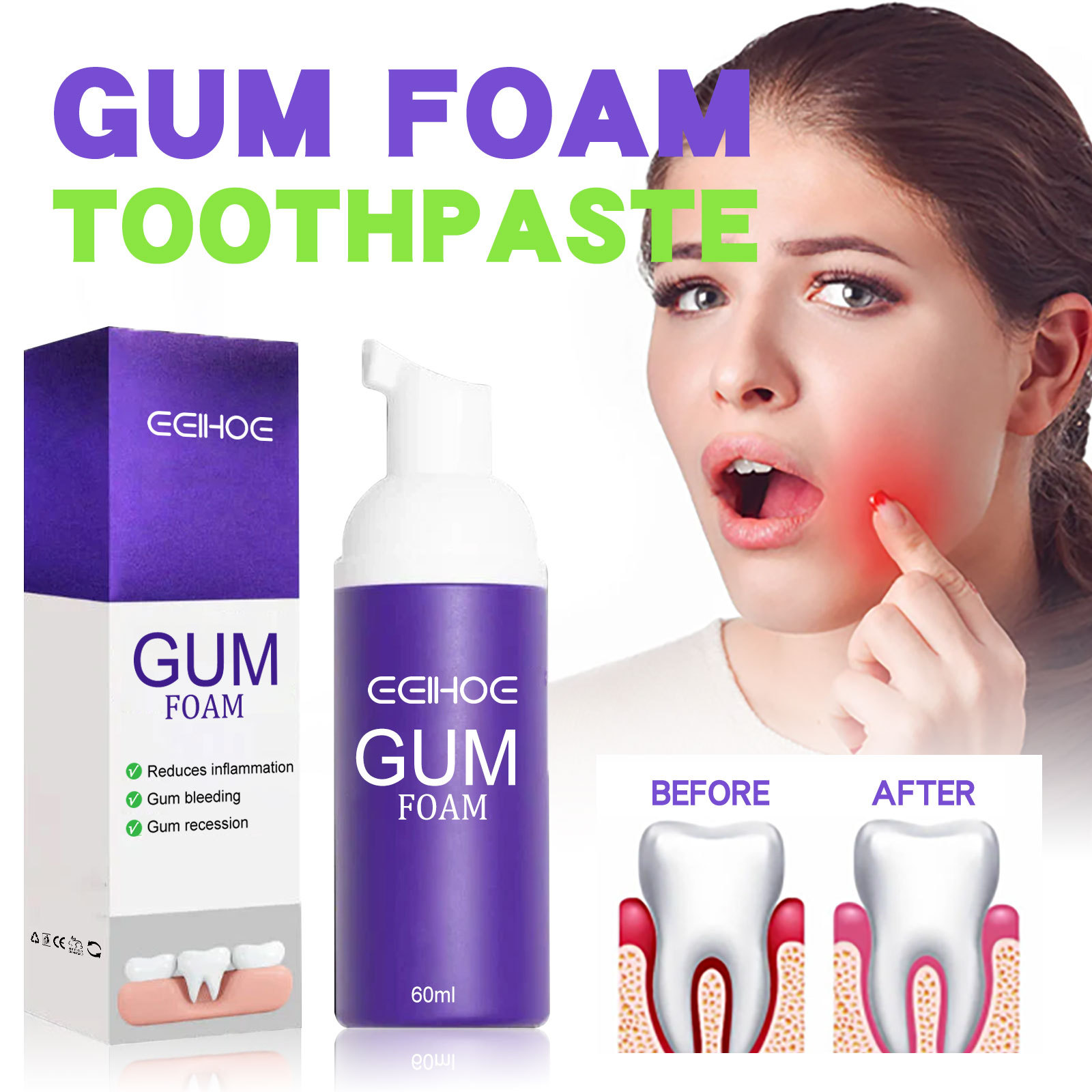 60ml Teeth Whitening Mousse V3 - Teeth Whitening Yellow Teeth review and price