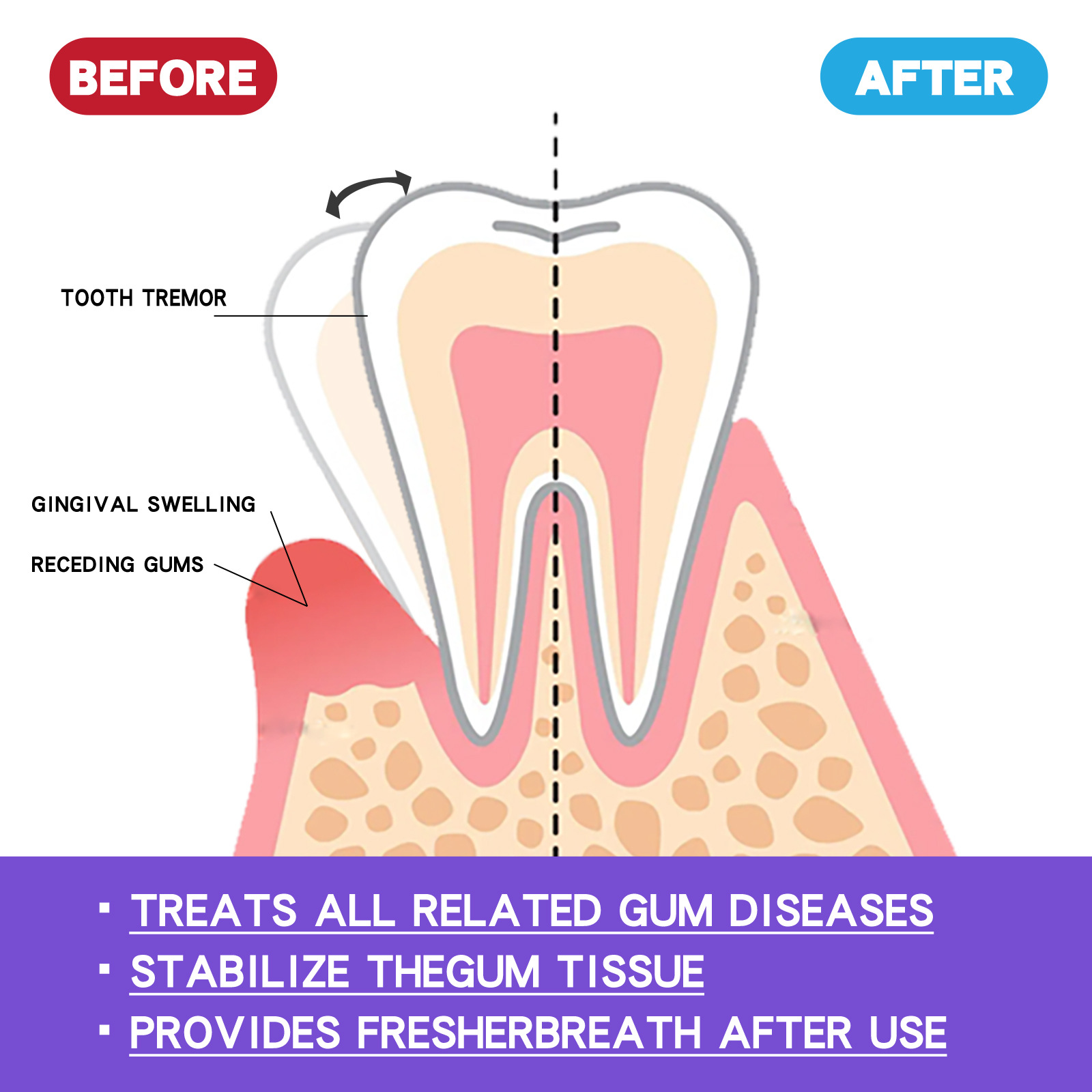 60ml Teeth Whitening Mousse V3 - Teeth Whitening Yellow Teeth review and price