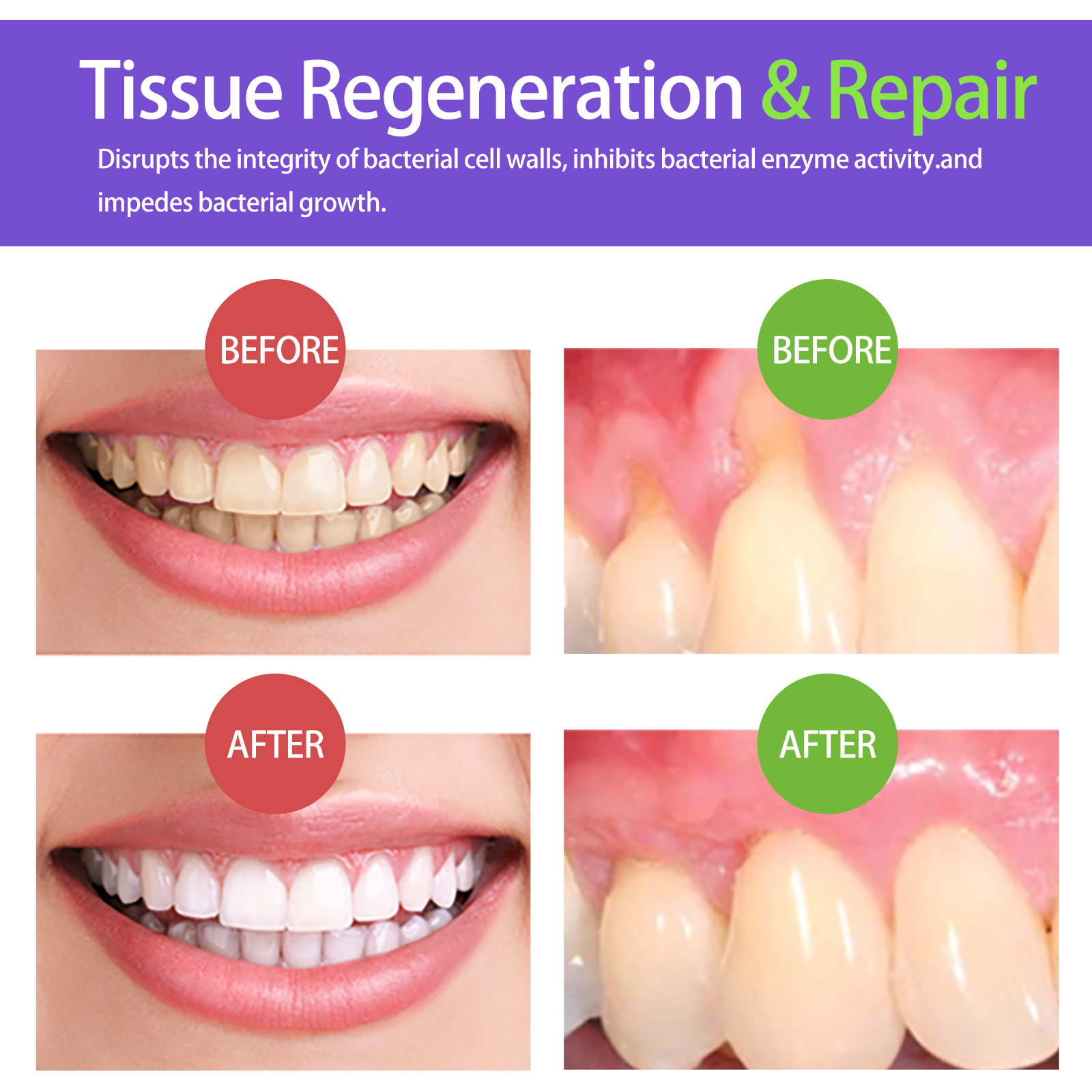 60ml Teeth Whitening Mousse V3 - Teeth Whitening Yellow Teeth review and price