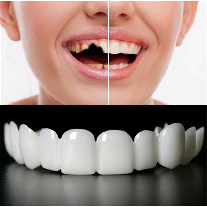[NEW!ABMK】 2 Pairs,Regain Beau - Teeth Whitening For Braces review and price