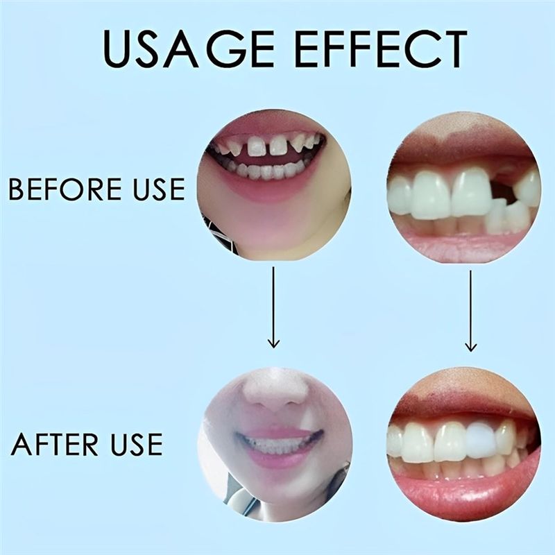 [NEW!ABMK】 2 Pairs,Regain Beau - Teeth Whitening For Braces review and price