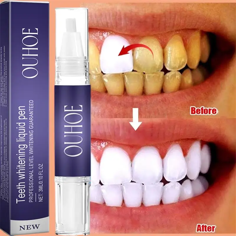 Fast Teeth Whtening Toothpaste - Whitening Pen Bleach review and price