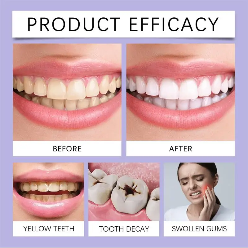 Fast Teeth Whtening Toothpaste - Whitening Pen Bleach review and price